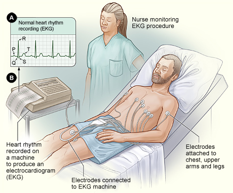Electrocardiogram Or Ekg At Brattleboro Memorial Hospital